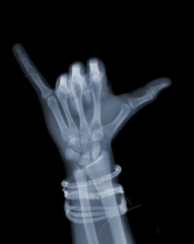 Hang Loose with Bands